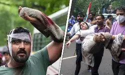 दिल्ली के बाद पटना तक पहुंचा छात्र आंदोलन: AISA के प्रदर्शन में पुलिस से झड़प, आंसू गैस और लाठीचार्ज