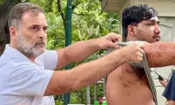 राहुल गांधी ने घायल छात्र को पेशकर लगाया आरोप, छात्रों पर पेलेट गन चलाकर सच छिपा रही सरकार