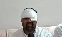 भारतीय किसान यूनियन (बीआर अंबेडकर) के अध्यक्ष दिग्विजय भाटी ने कहा-मेरठ एसएसपी और सिविल लाइन इंस्पेक्टर ने किया थर्ड-डिग्री टॉर्चर, एक आंख फोड़ने का आरोप भारतीय किसान यूनियन (बीआर अंबेडकर) के अध्यक्ष दिग्विजय भाटी ने कहा-मेरठ एसएसपी और सिविल लाइन इंस्पेक्टर ने किया थर्ड-डिग्री टॉर्चर, एक आंख फोड़ने का आरोप