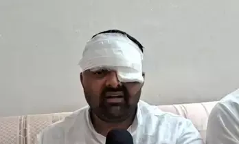 भारतीय किसान यूनियन (बीआर अंबेडकर) के अध्यक्ष दिग्विजय भाटी ने कहा-मेरठ एसएसपी और सिविल लाइन इंस्पेक्टर ने किया थर्ड-डिग्री टॉर्चर, एक आंख फोड़ने का आरोप भारतीय किसान यूनियन (बीआर अंबेडकर) के अध्यक्ष दिग्विजय भाटी ने कहा-मेरठ एसएसपी और सिविल लाइन इंस्पेक्टर ने किया थर्ड-डिग्री टॉर्चर, एक आंख फोड़ने का आरोप