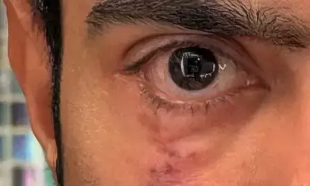 अमेरिका से अभिषेक बनर्जी की स्कार पोस्ट से सियासी हलचल, जानिए क्या लिखा इंस्टाग्राम स्टोरी पर