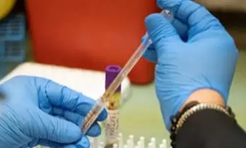 साइबेरिया के रूसी संस्थान में प्लेग से मौत के मामले पर सस्पेंस बरकरार; जानिए अब तक क्या पता चला है साइबेरिया के रूसी संस्थान में प्लेग से मौत के मामले पर सस्पेंस बरकरार; जानिए अब तक क्या पता चला है